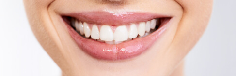 dental checkups, teeth whitening