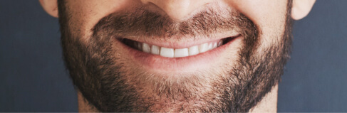 teeth crowns and bridges