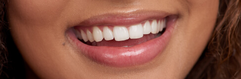 teeth implant restoration, teeth hygiene