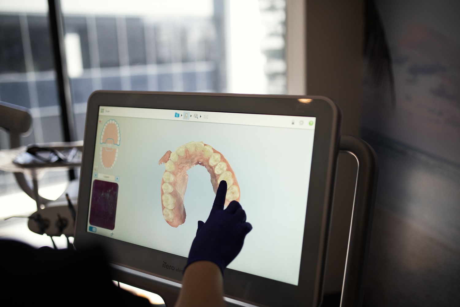 cosmetic dentistry by Oracle Dental Broadbeach