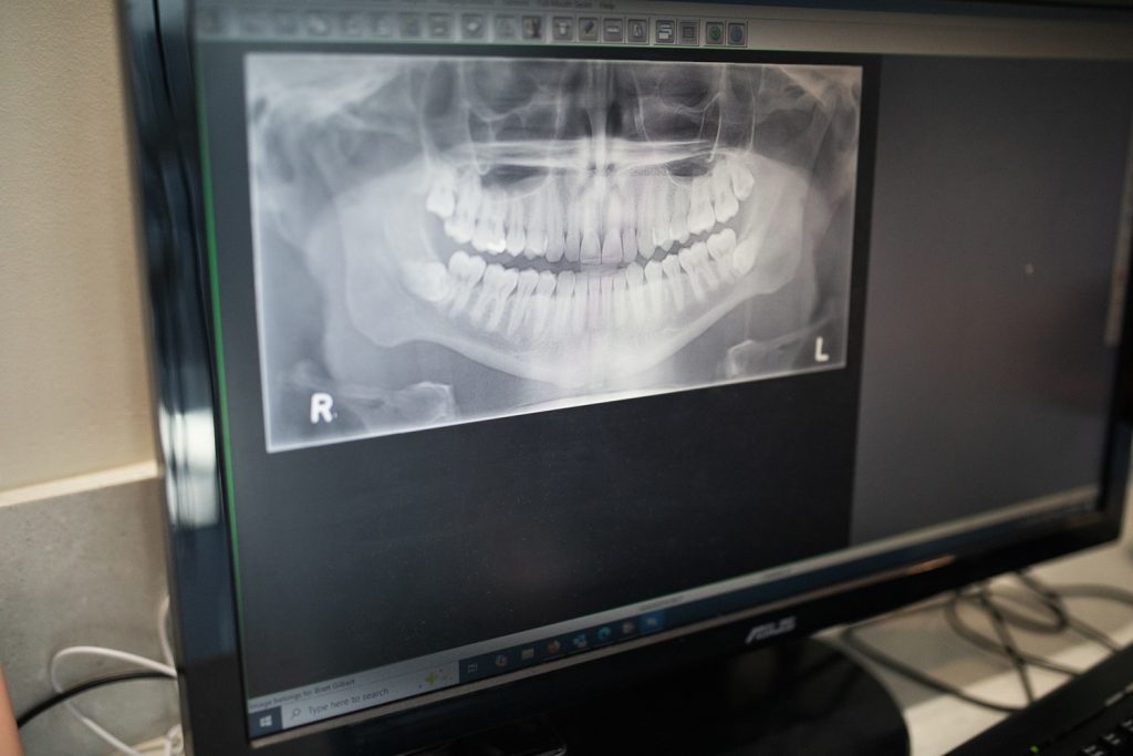 sleep dentistry by Oracle Dental Broadbeach