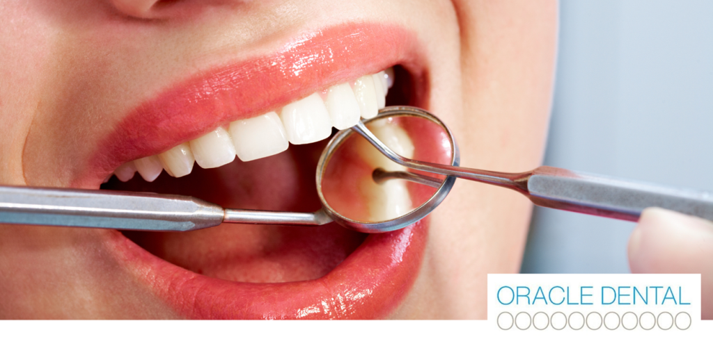 What Happens During a Dental Check-Up and Clean with Oracle Dental Broadbeach