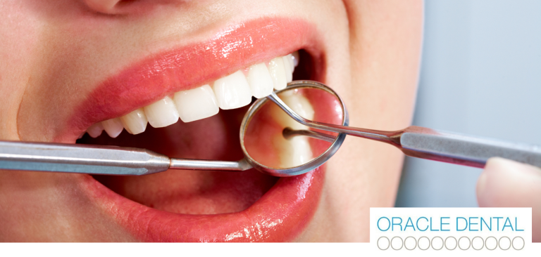 What Happens During a Dental Check-Up and Clean with Oracle Dental Broadbeach